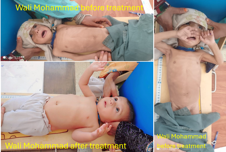 Wali Mohammad Breaking the cycle of malnutrition in AAIWO